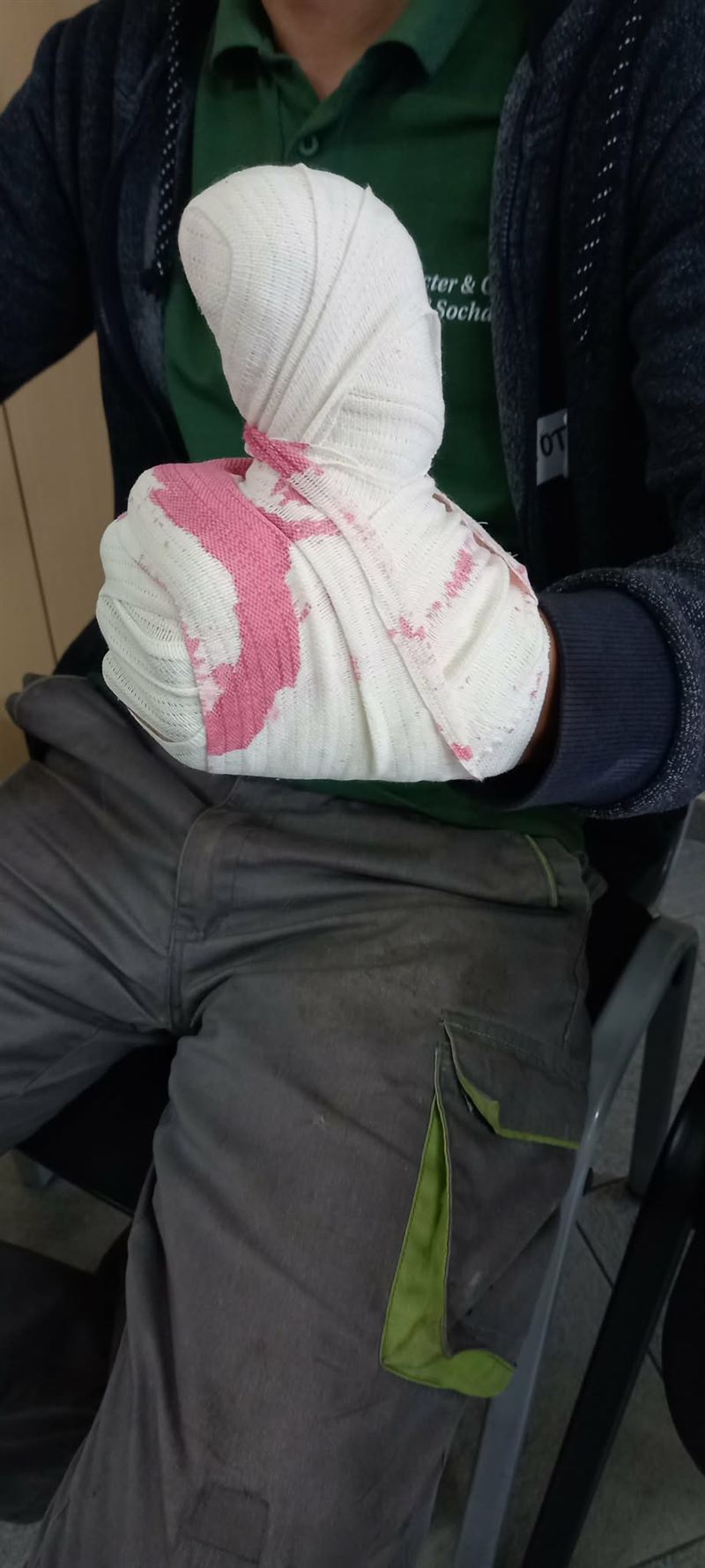 Opatrunek dłoni z pozoracją krwawienia
